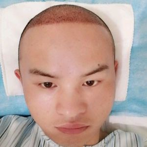 发际线分享社区