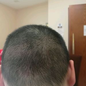 发际线分享社区
