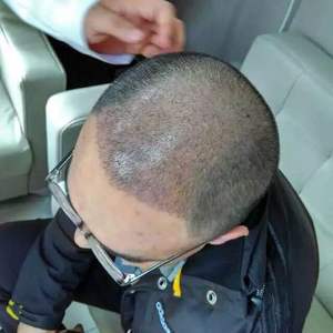 发际线分享社区