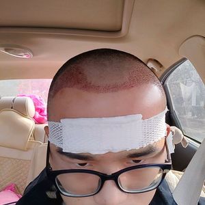 发际线分享社区