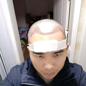 发际线分享社区