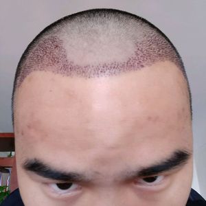 发际线分享社区