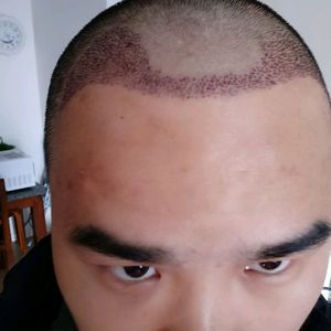 发际线分享社区
