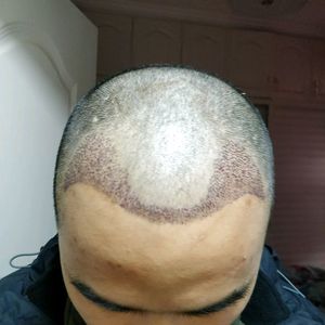 发际线分享社区