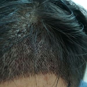 发际线分享社区