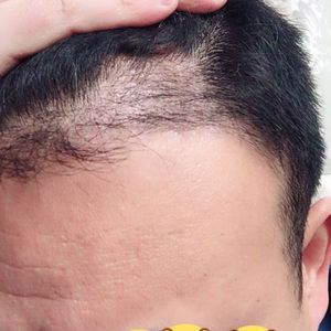 发际线分享社区
