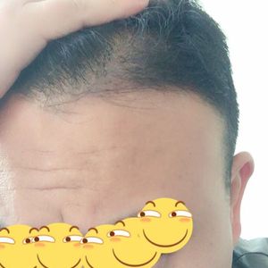 发际线分享社区