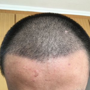 发际线分享社区