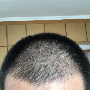 发际线分享社区