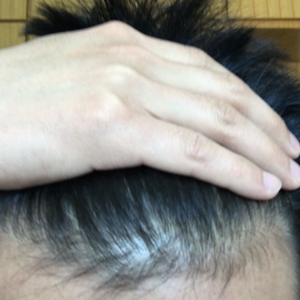 发际线分享社区