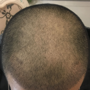 发际线分享社区