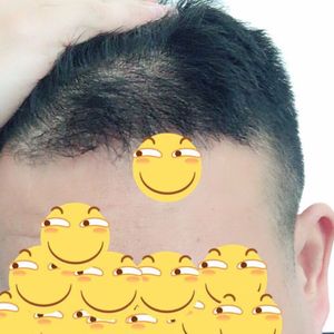 发际线分享社区