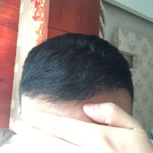 发际线分享社区