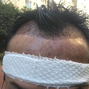 发际线分享社区