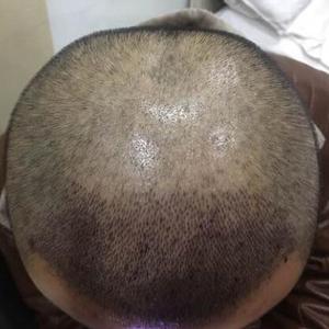 发际线分享社区