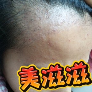 发际线分享社区