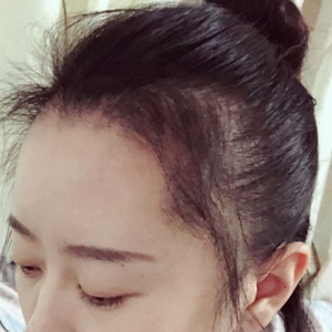 发际线分享社区
