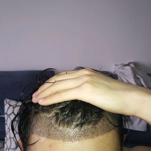 发际线分享社区