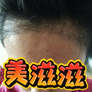 发际线分享社区