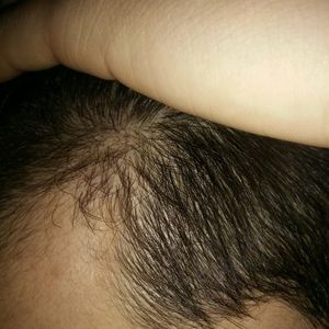 发际线分享社区
