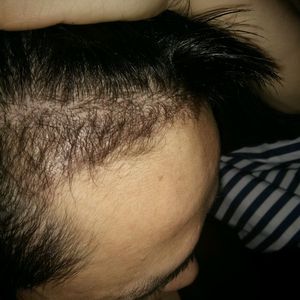 发际线分享社区