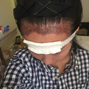 发际线分享社区