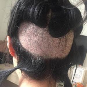发际线分享社区