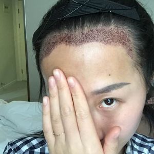 发际线分享社区