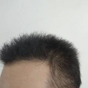 发际线分享社区