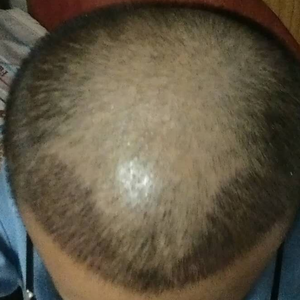 发际线分享社区