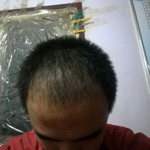 发际线分享社区