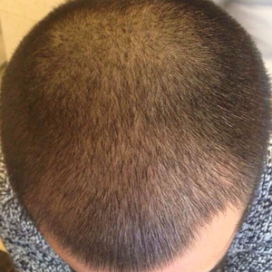 发际线分享社区