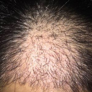 发际线分享社区