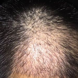发际线分享社区