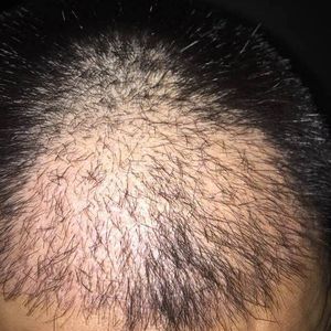发际线分享社区
