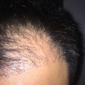 发际线分享社区