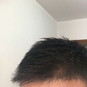 发际线分享社区
