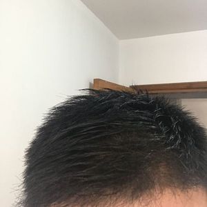 发际线分享社区