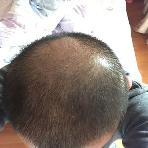 发际线分享社区