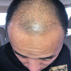 发际线分享社区
