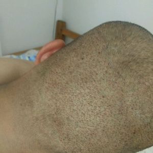 发际线分享社区