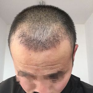 发际线分享社区