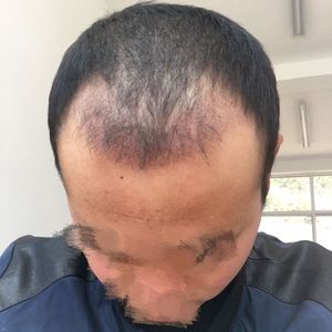 发际线分享社区