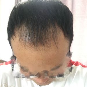 发际线分享社区