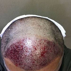 发际线分享社区