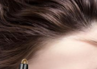 头发变细的原因有哪些？预防发际线后移的四大措施