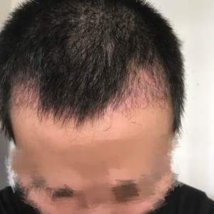 发际线分享社区