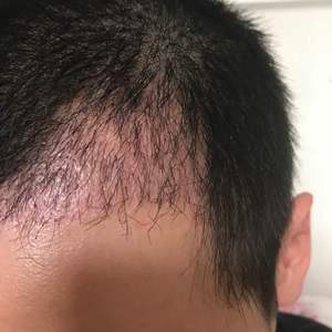 发际线分享社区