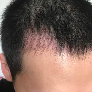 发际线分享社区