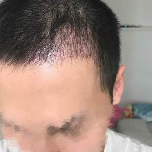 发际线分享社区